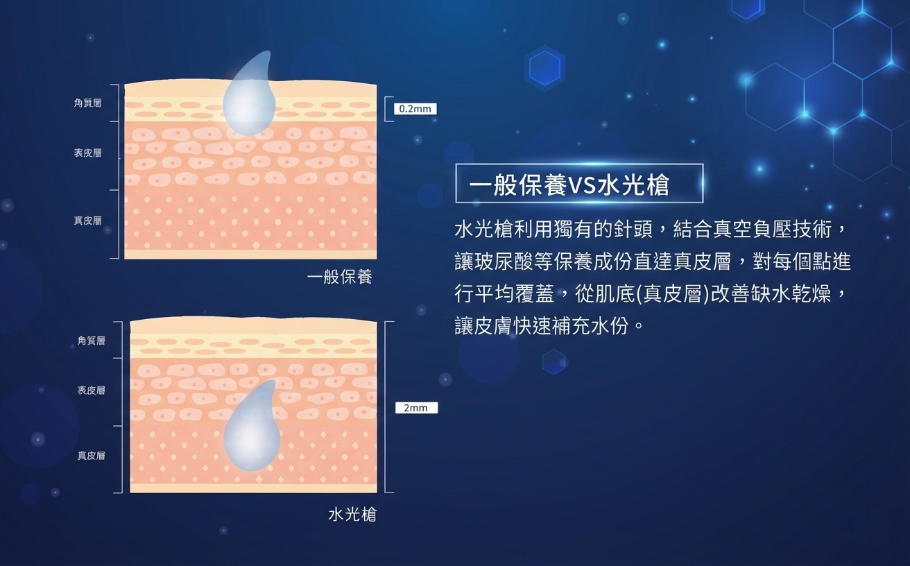 水光槍Vital Injector3 vs 一般保養