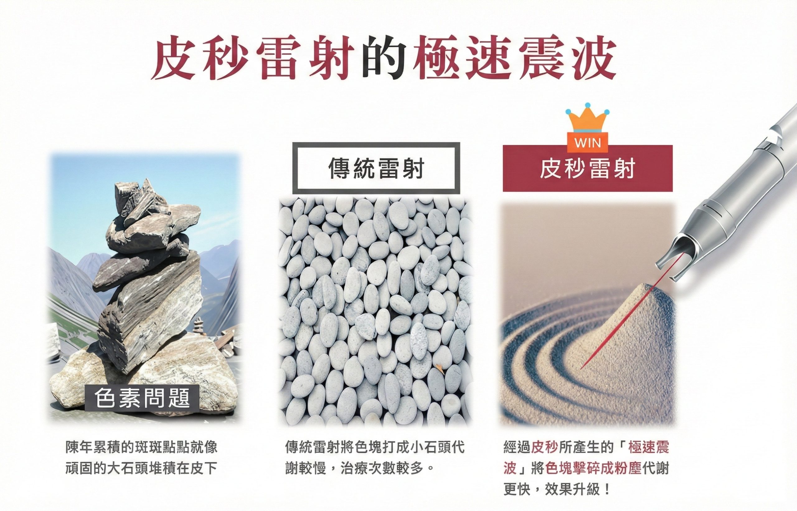 PICOCARE vs 傳統雷射